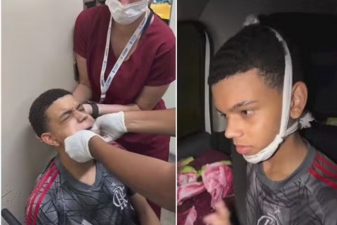 Jovem de 14 anos desloca a mandíbula ao bocejar e irmão expõe bastidores do socorro